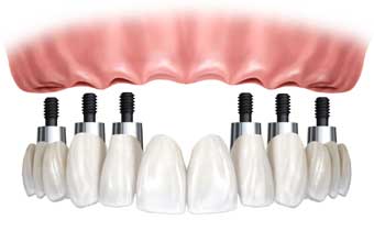 Schiavo Odontologia - Foto 1