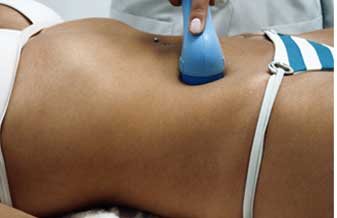 Antonio Reis de Rezende - Foto 1